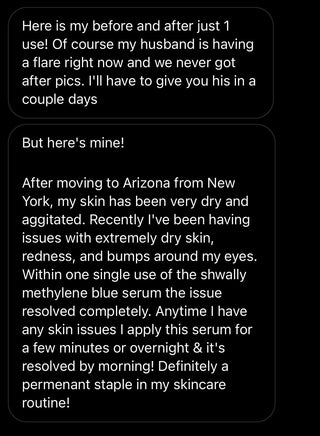 NEW Shwally Methylene Blue Daily Sunshine Serum + Liposomal Copper Peptides Option