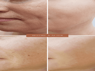 ORGANIC HYALURONIC WRINKLE DEFIER -  For Women and Men