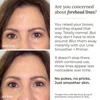 Line Smoother + Primer with Neodermyl®