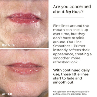 Line Smoother + Primer with Neodermyl®
